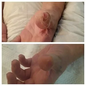 Dermatitis client story