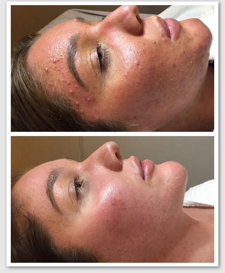 DMK client story