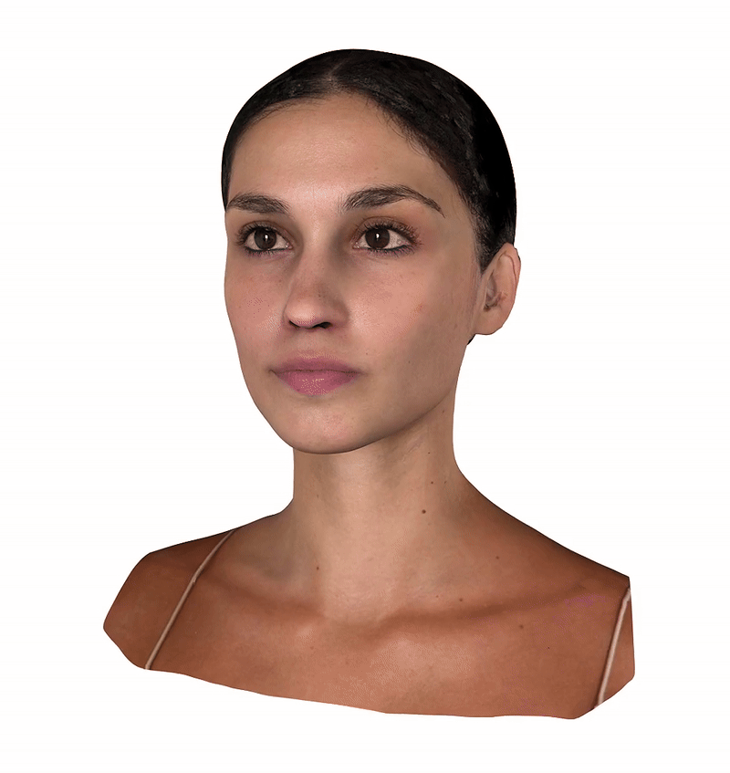 Crisalix 3D Rhinoplasty Planning: See Your Results Before Surgery