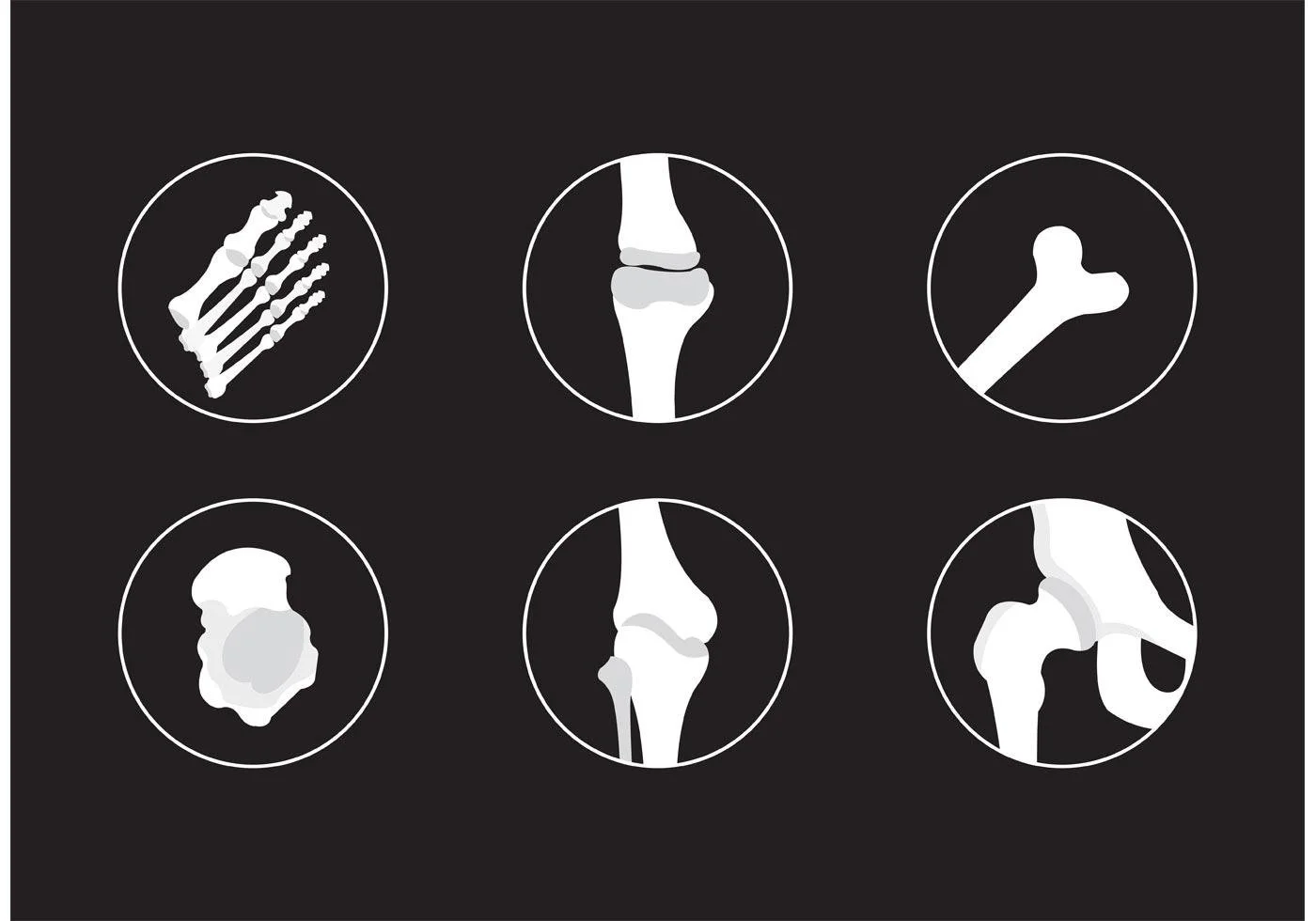 High Calcium Blood Test: Could It Be Hyperparathyroidism?