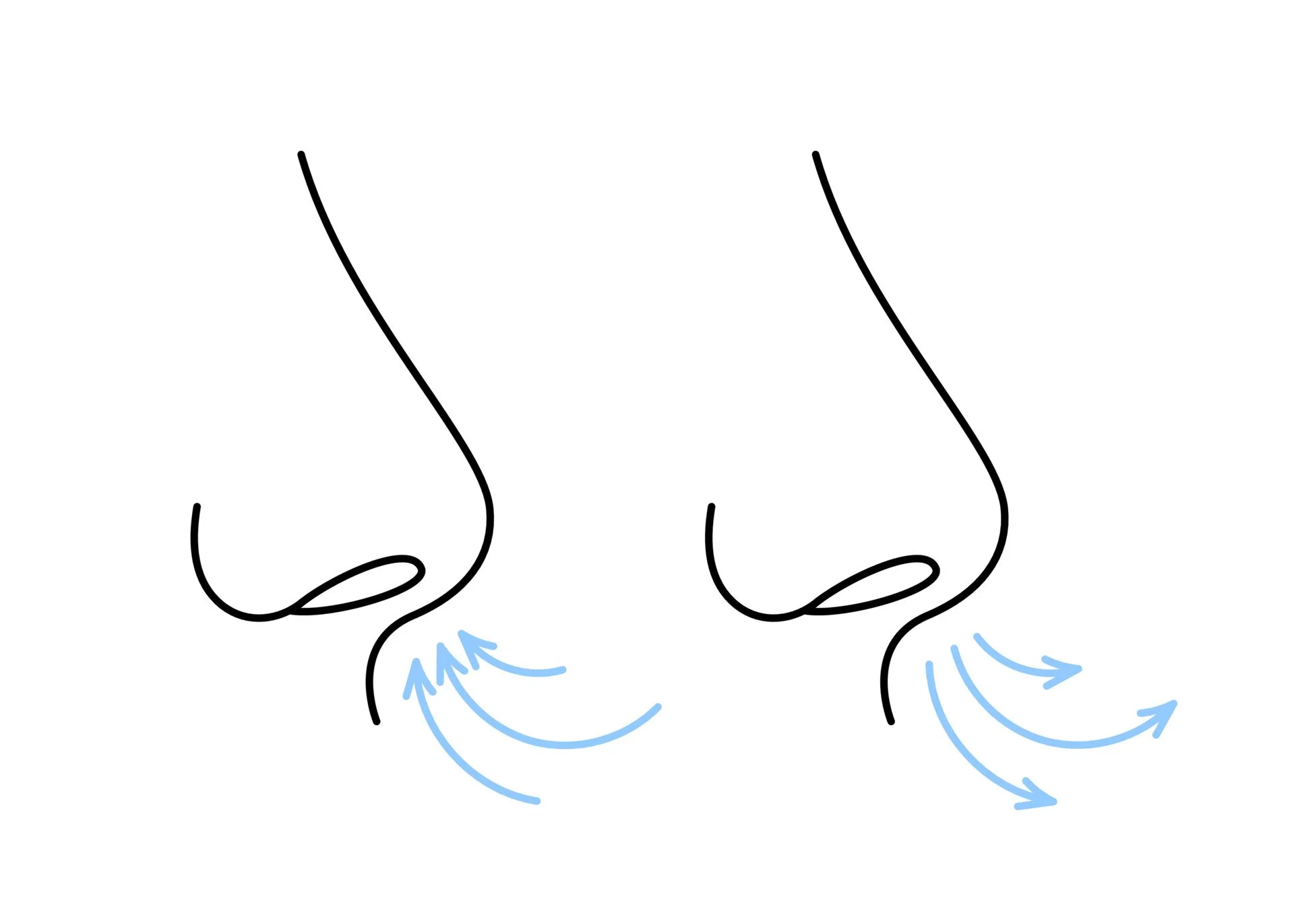 Septorhinoplasty for Breathing and Appearance: When Function and Aesthetics Need to Be Treated Together