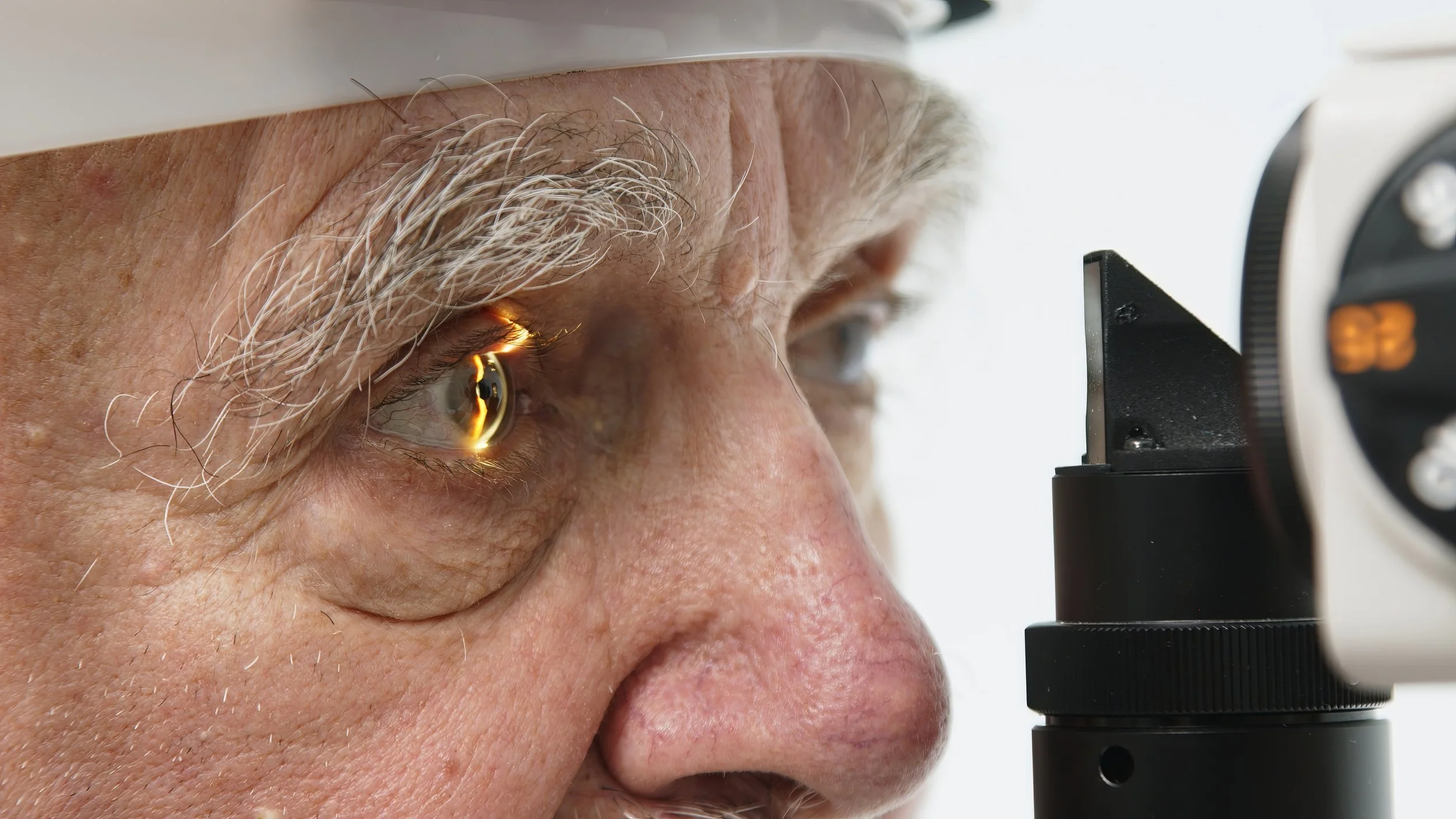Watery Eyes and Blocked Tear Ducts: DCR Surgery at Medicana Winchester