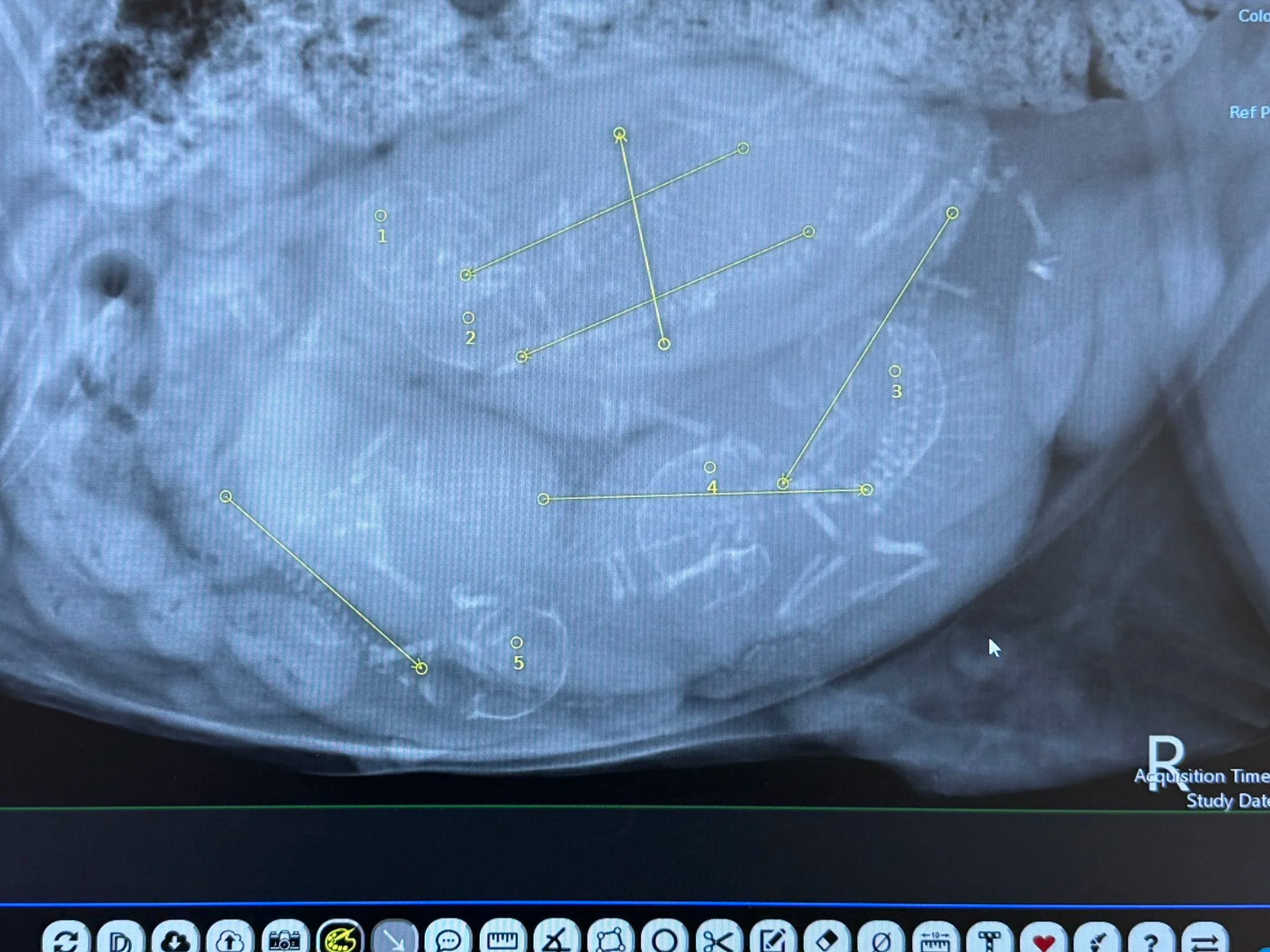 5 Kittens Confirmed! 