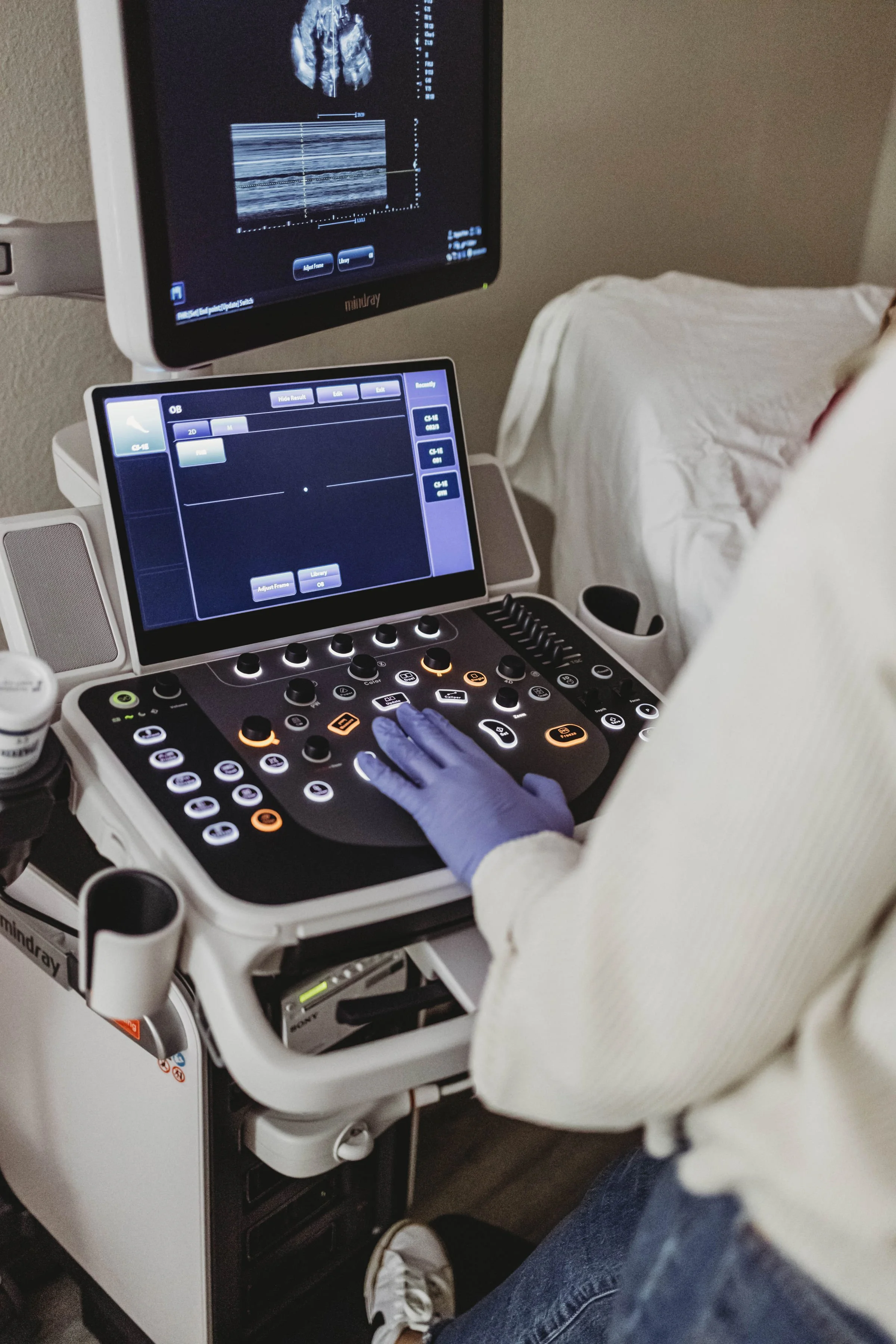 Why Should I Get an Ultrasound if I’m Considering Abortion?