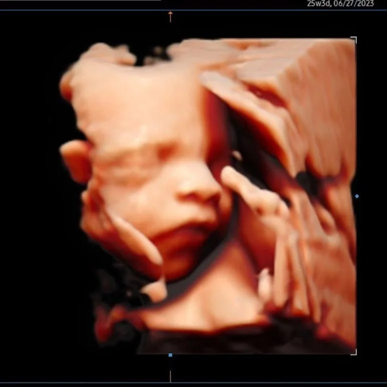 Bundles Ultrasound Boutique 3D 4D Ultrasound Photography bundles-ultrasound-boutique-3d-4d-ultrasound-photography