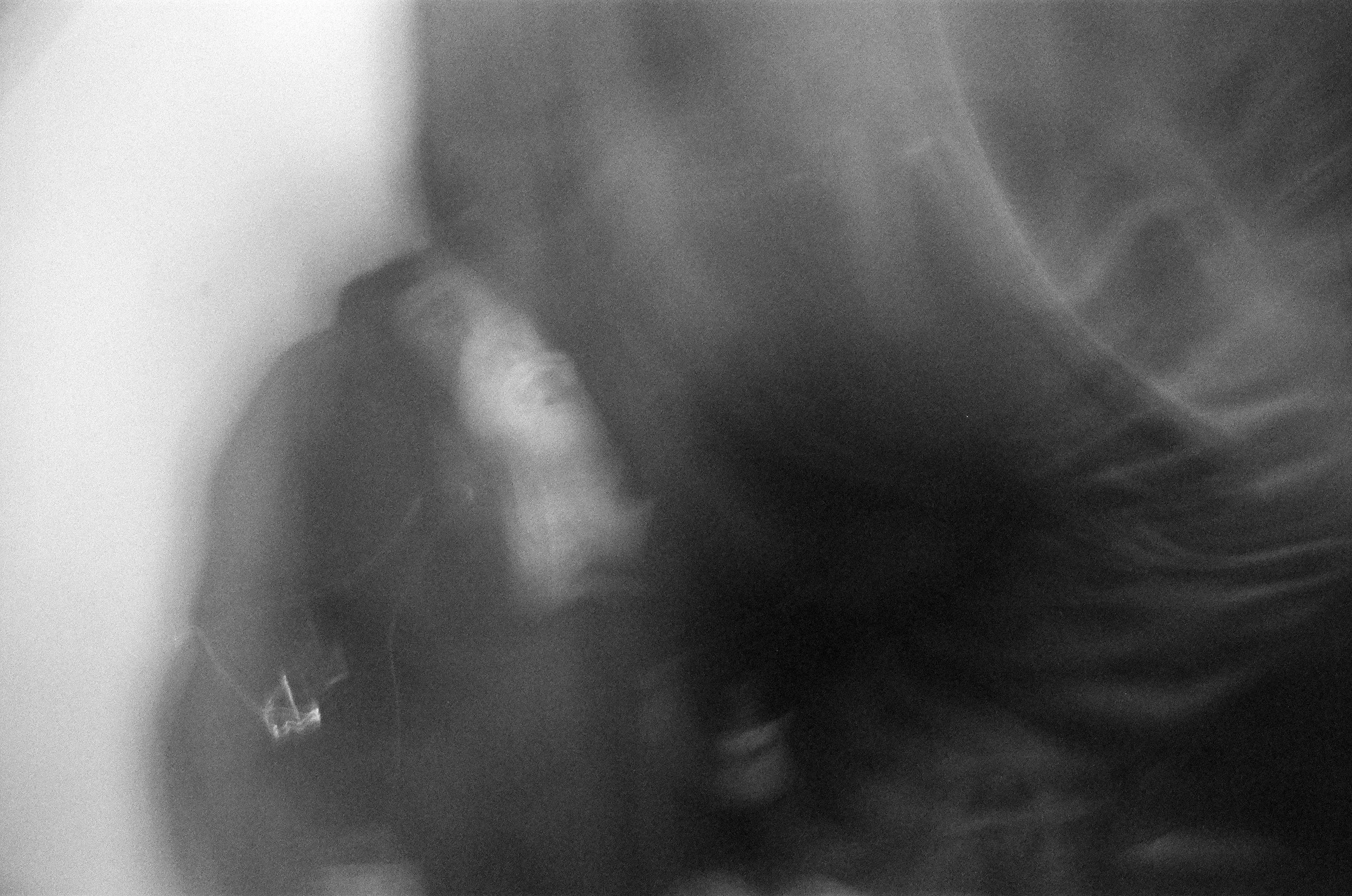 Lonely in a Connected World: Modern Isolation and Mental Health