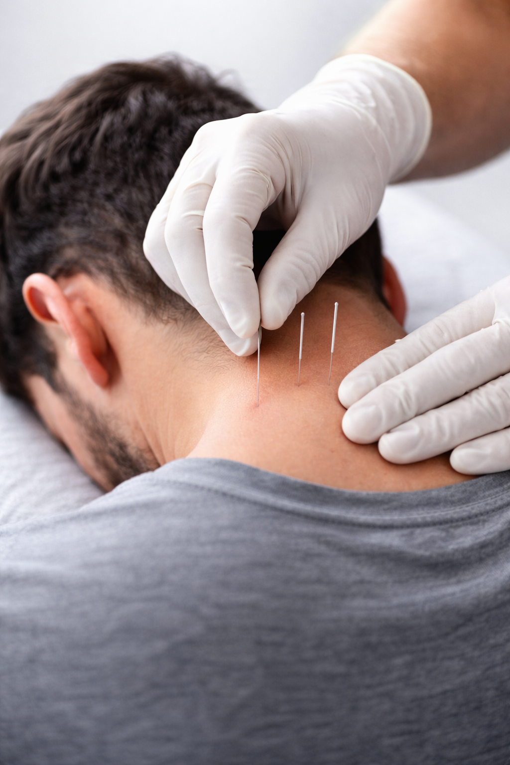 Can Dry Needling Help Neck Pain?