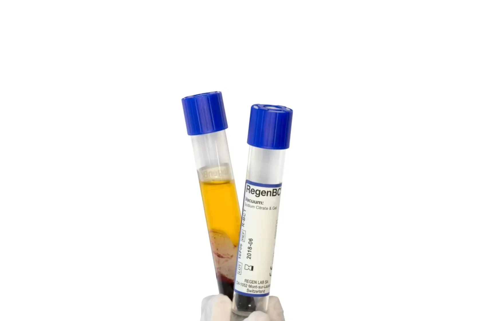Plasma Rich Protein (PRP)