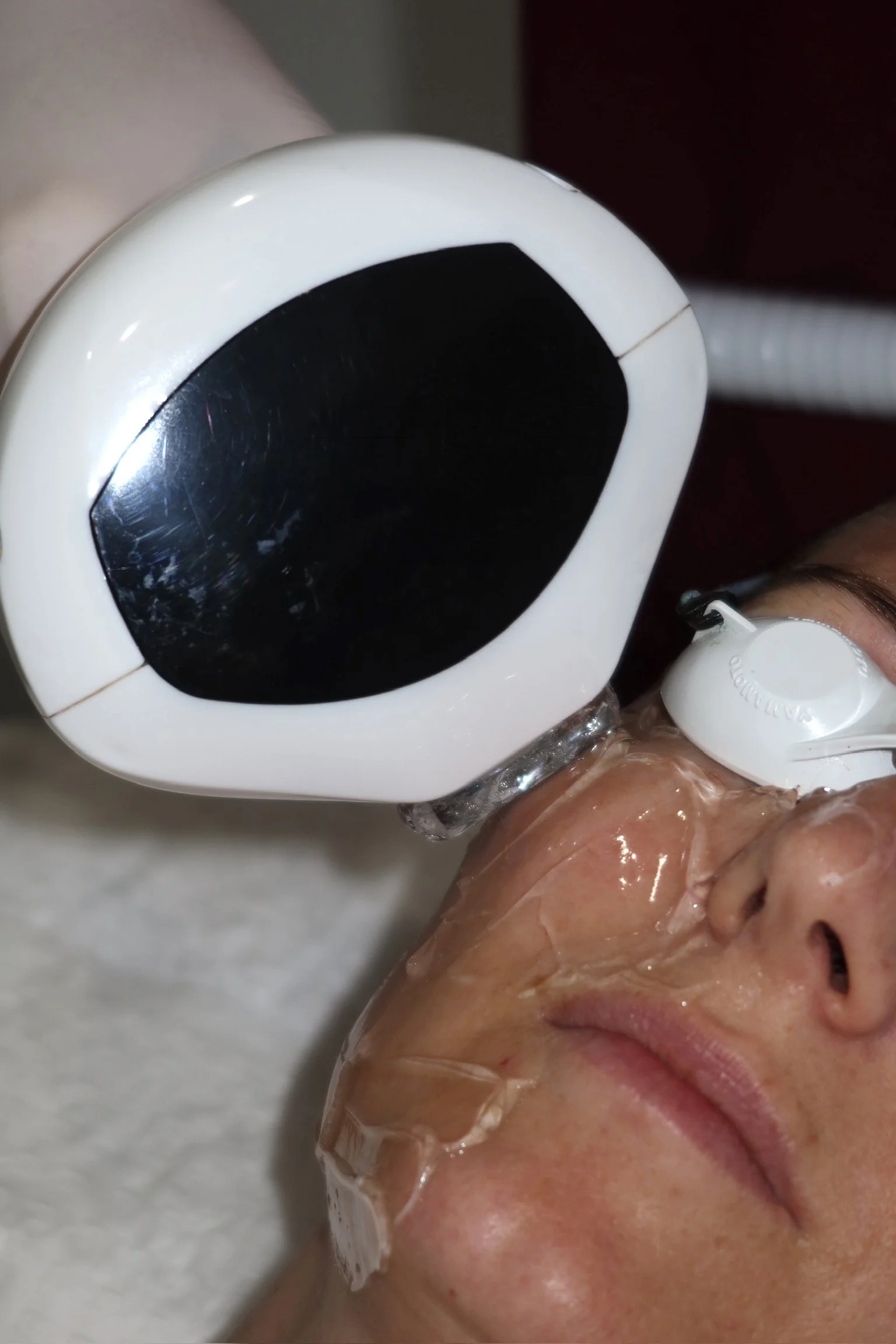 BOXING DAY 40% OFF LUMECCA FULL FACE