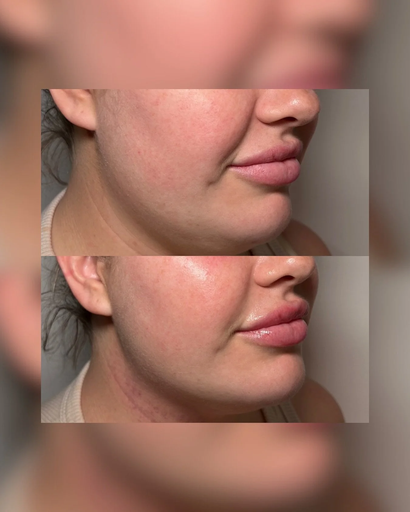 Pigmentation month may be shining the spotlight, but our other treatments have been just as loved &hearts;️

We cannot thank you enough for trusting us with your skin journeys.

And just to prove it&hellip; here&rsquo;s our Director&rsquo;s own befor