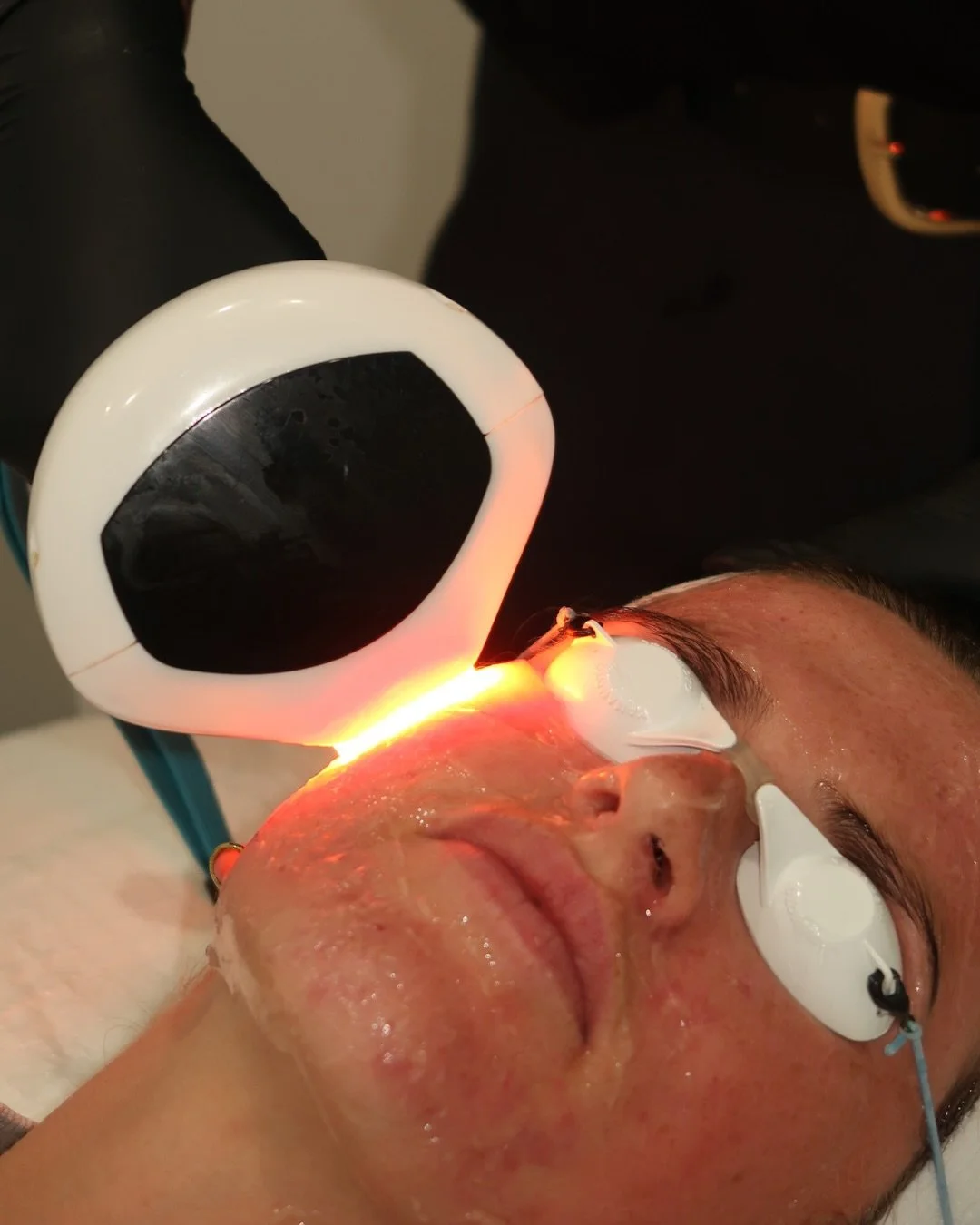 Sun, stress, and time leave their mark🫣

Now is the moment to refresh your skin. 

Targets pigmentation, sun damage, and uneven tone for visible, lasting results. 

Book your Summer skin reset x 

#skinstudiobylaura #goldcoast #kirra #coolangatta