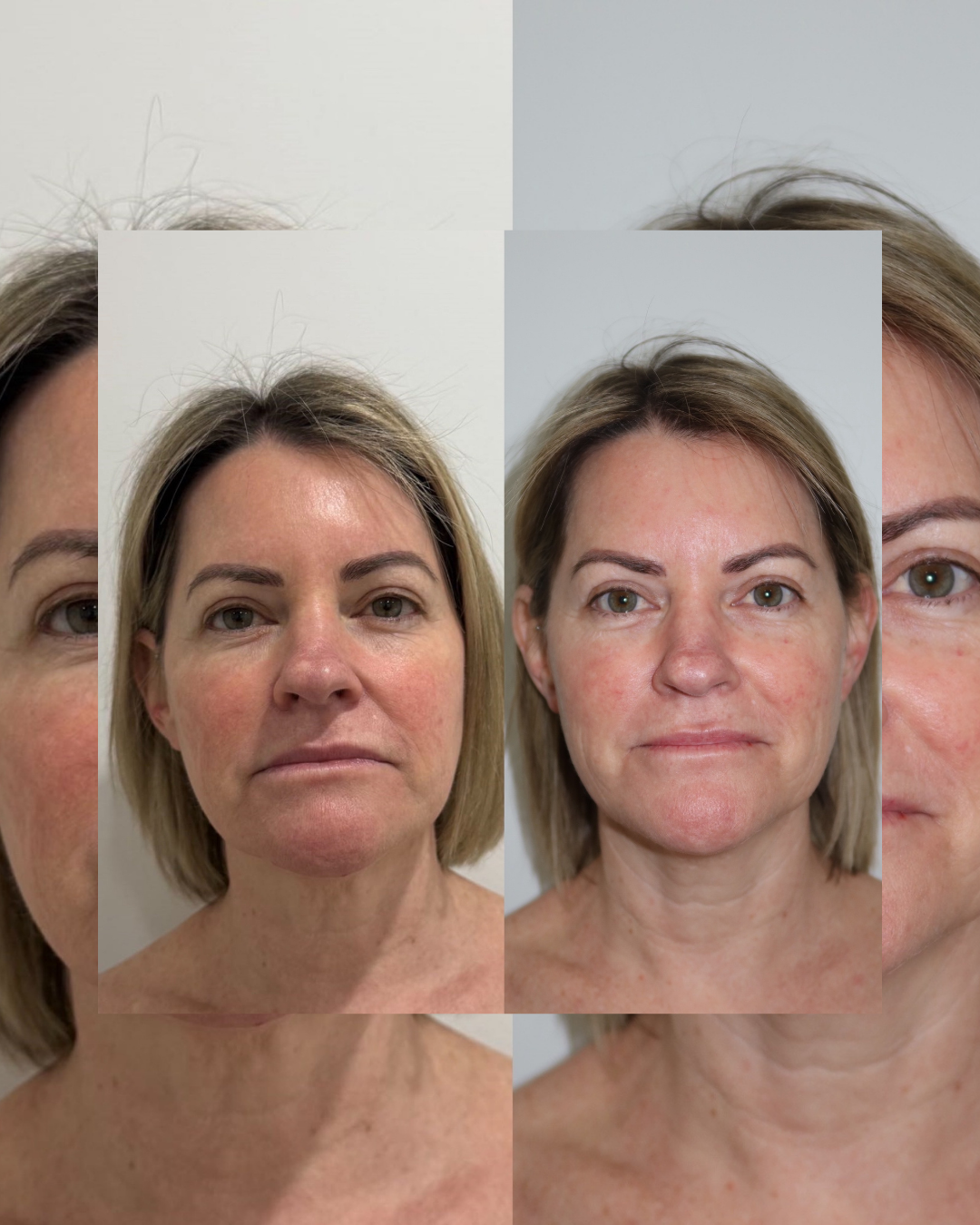 SKINSTUDIO SM - 287.PNG