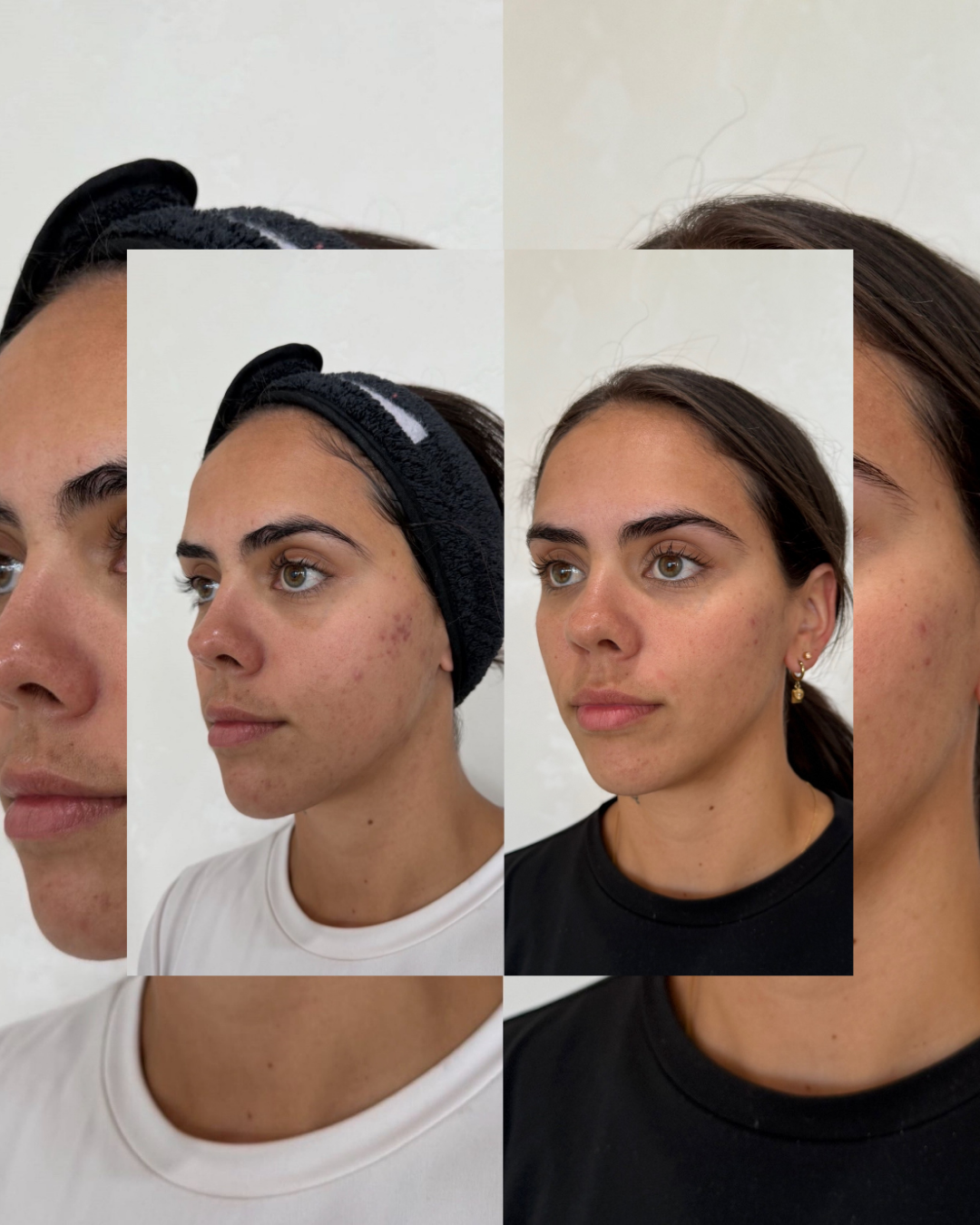 SKINSTUDIO SM - 212.PNG