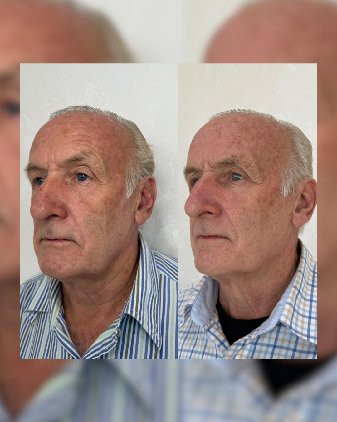 SKINSTUDIO SM - 193.PNG