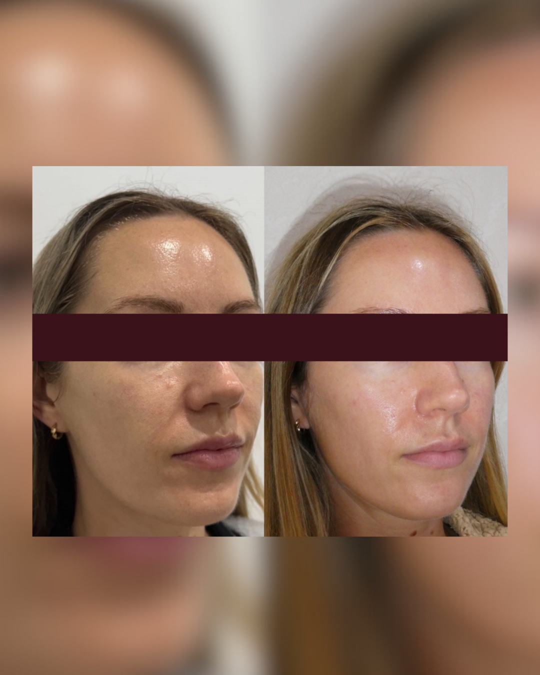 SKINSTUDIO SM - 91.PNG