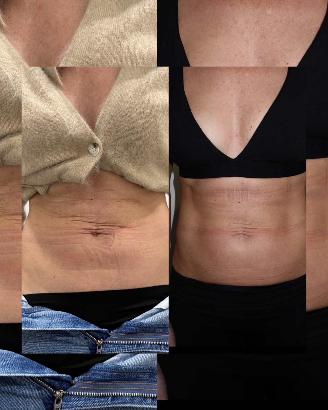 SKINSTUDIO SM - 303.PNG