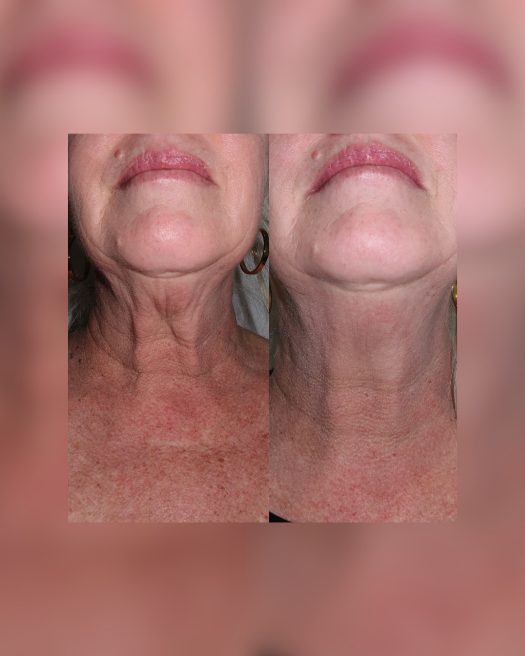 SKINSTUDIO SM - 83.PNG