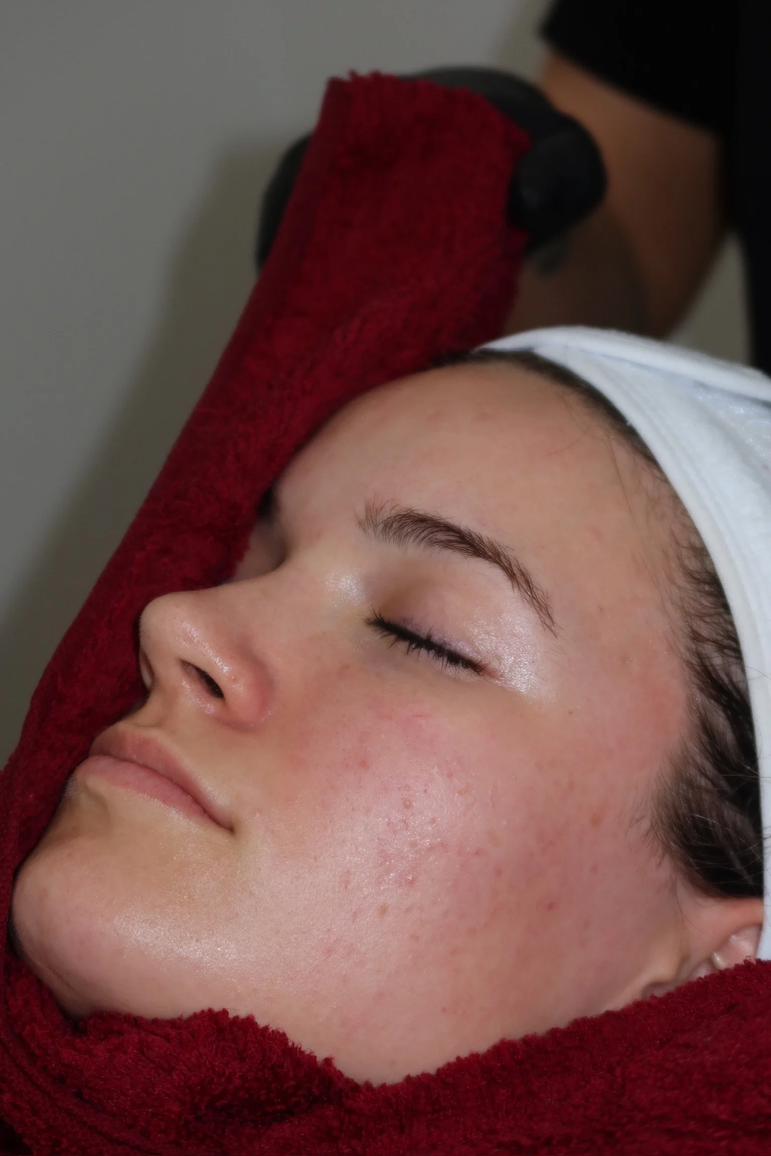 Dermaplaning facial