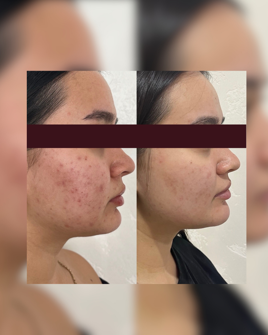 SKINSTUDIO SM - 109.PNG