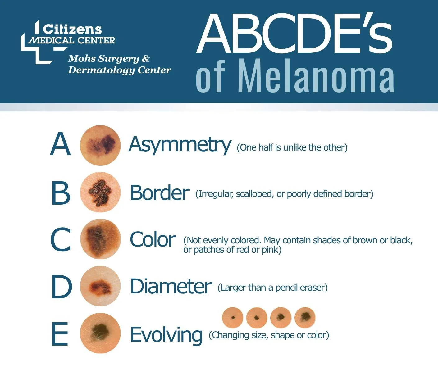May is Melanoma and Skin Cancer Awareness Month. 🎗Skin cancer is one of the most preventable forms of cancer, and early detection can make all the difference.

☀️ As the sun comes out and we spend more time outdoors, take steps to protect your skin 