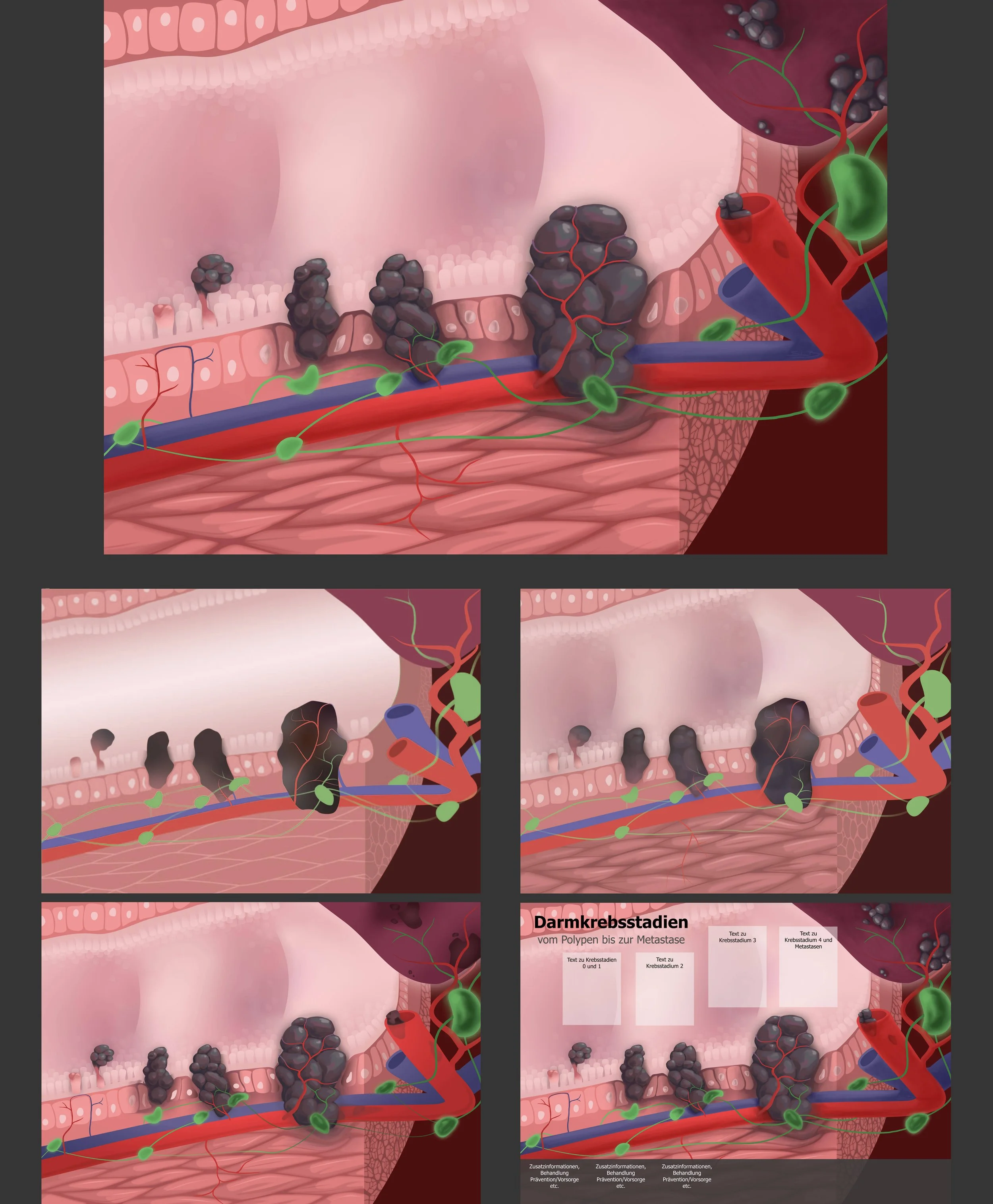 Mischtechnik: Vektor Illustration und 2D Zeichnung darüber