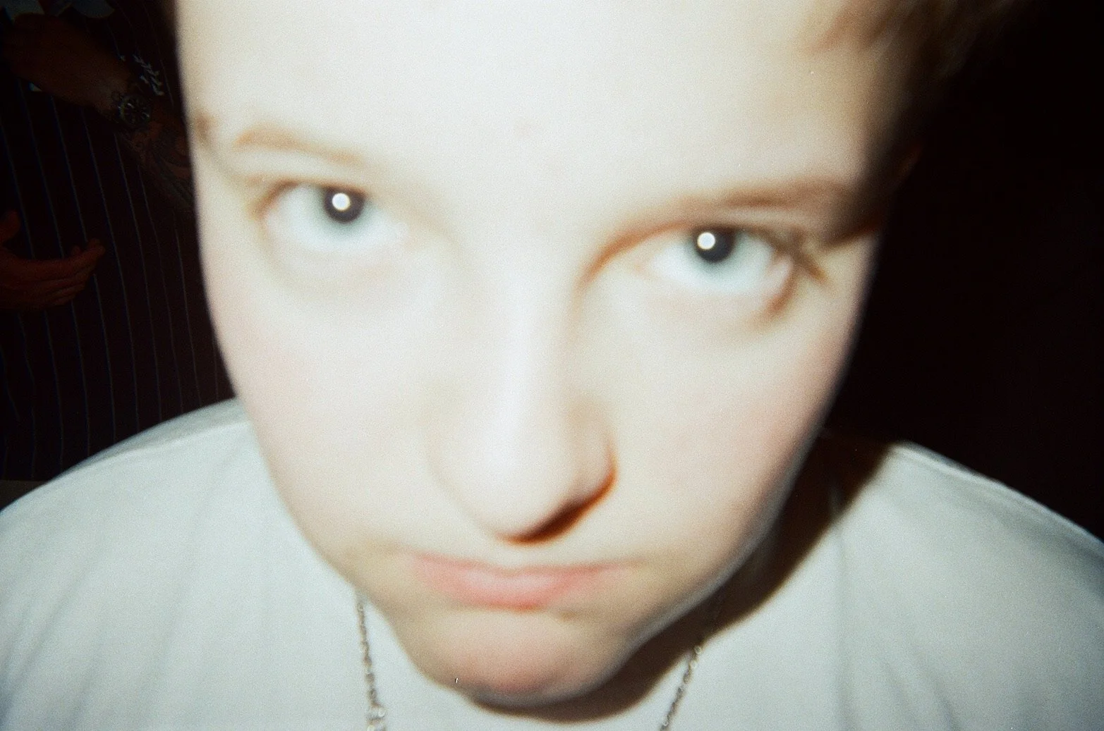 Close-up of a person's face looking directly at the camera, with a neutral expression and white shirt.
