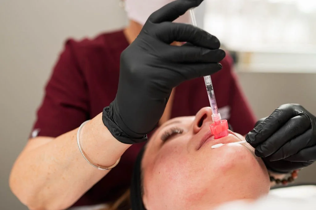 Lip filler enhancement results showing natural volume in Biddeford, Maine