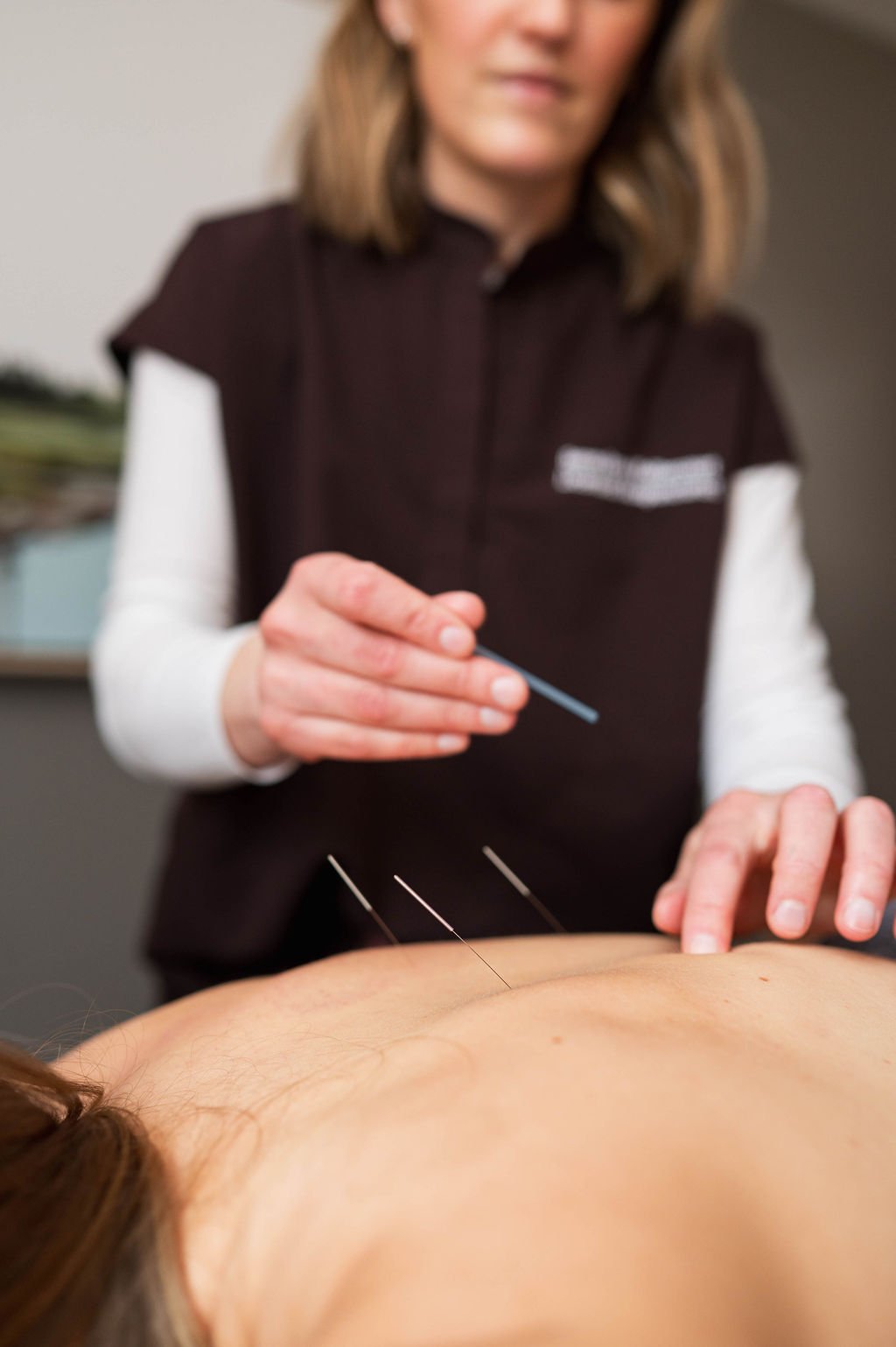 professional acupuncture in a clinical office setting