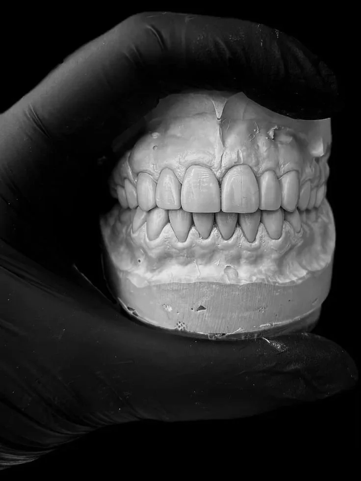 A human skull model with dental impressions held by a gloved hand.