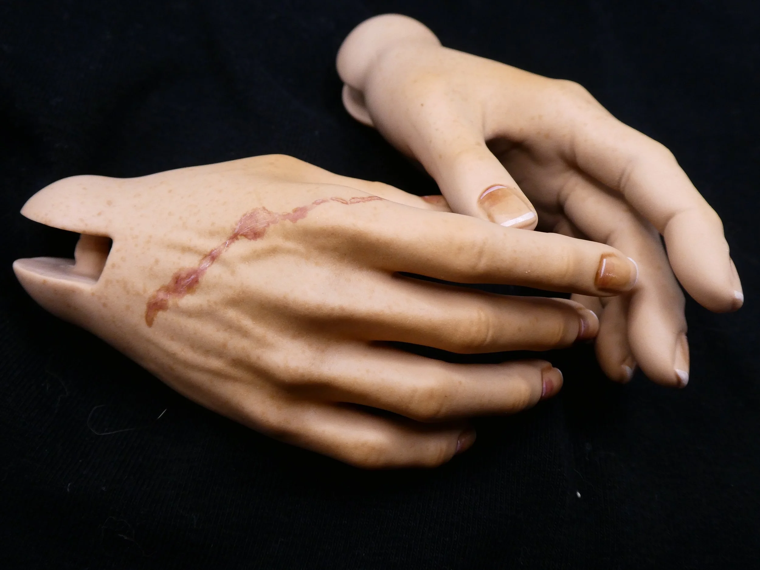 Iplehouse Hand Blushing and Scars