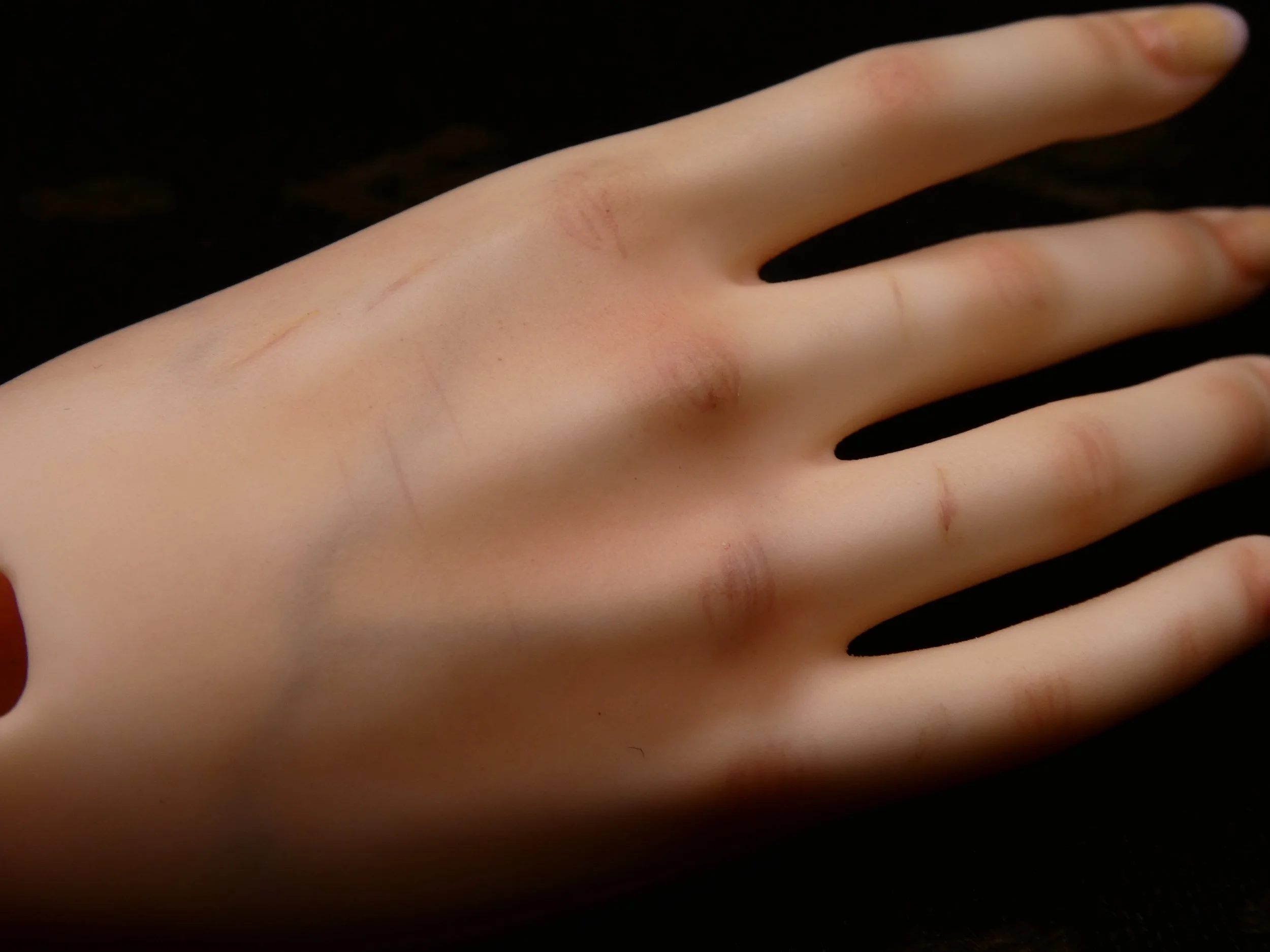 Iplehouse Hand Blushing with Battle Scars