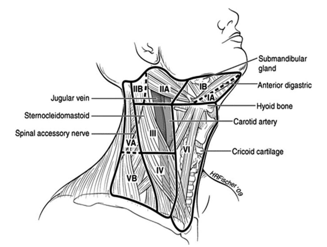 An anatomical diagram of the human neck showing muscles, bones, arteries, veins, nerves, and cartilages including the submandibular gland, anterior digastric, hyoid bone, carotid artery, cricoid cartilage, jugular vein, sternocleidomastoid, spinal accessory nerve, and other labeled parts.