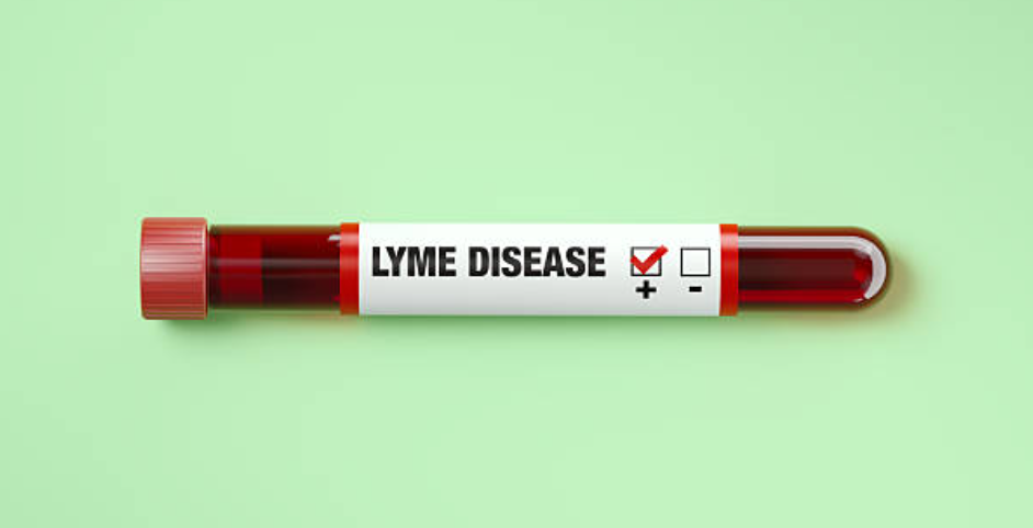 Blood sample tube showing a positive Lyme disease test result