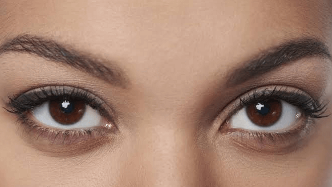 AccuTite: A New Option for Cosmetic Eye Enhancement