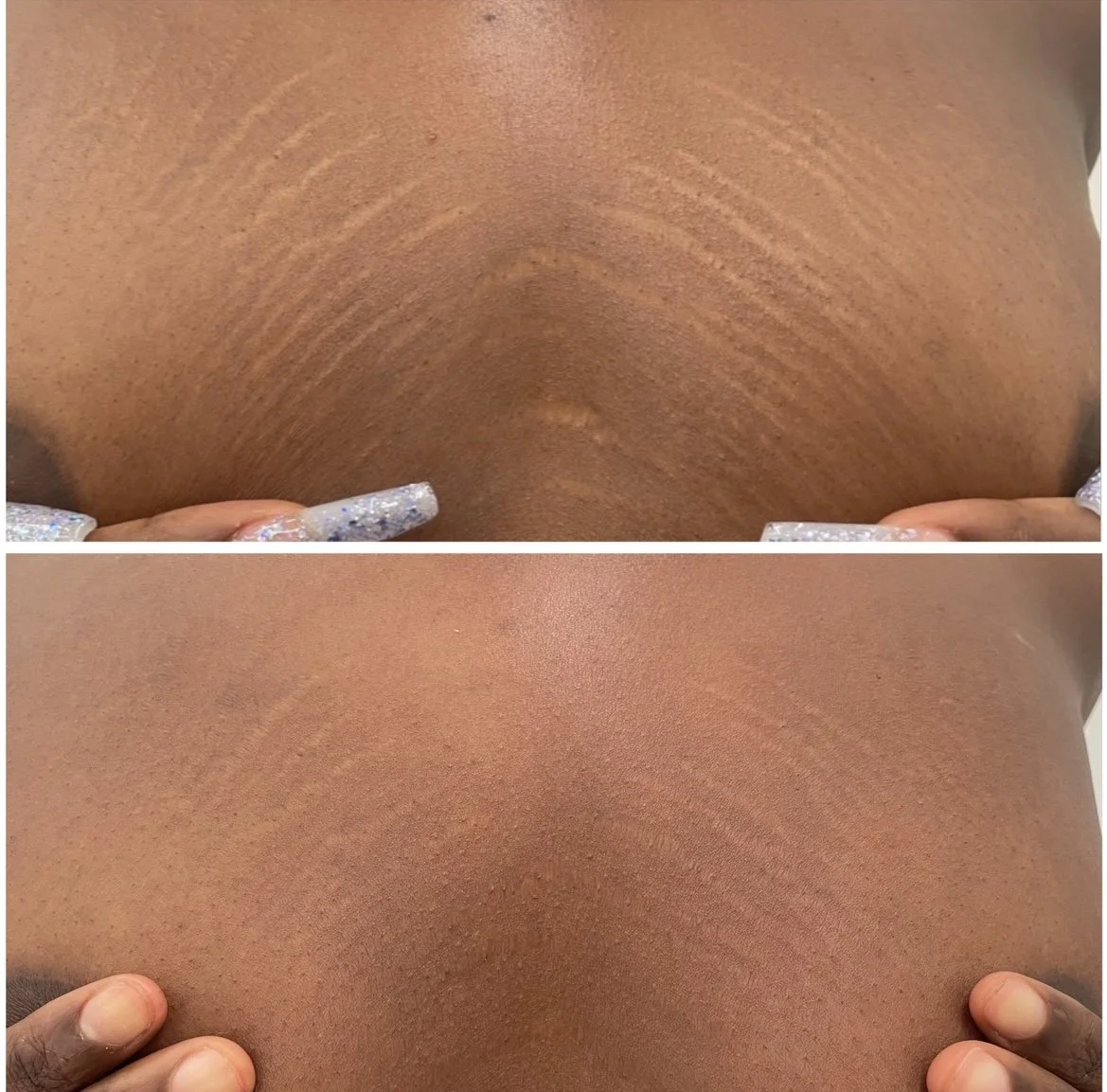 Comparison of the skin before and after applying a shimmery body makeup or spray, showing the skin's surface with and without the product for a smooth, even tone.