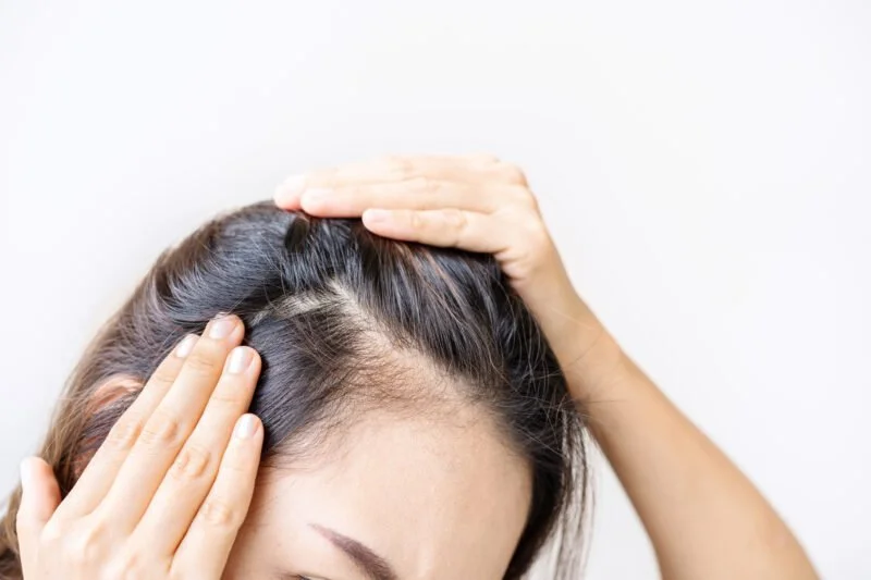 Hair Restoration Using Tattoo Needling: How It Works