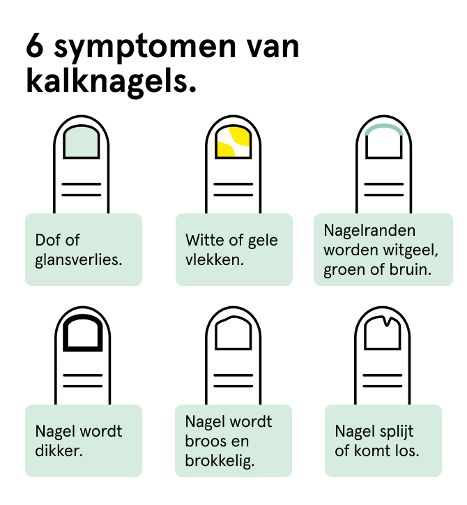 Infographic op adviespagina op Etos.nl
