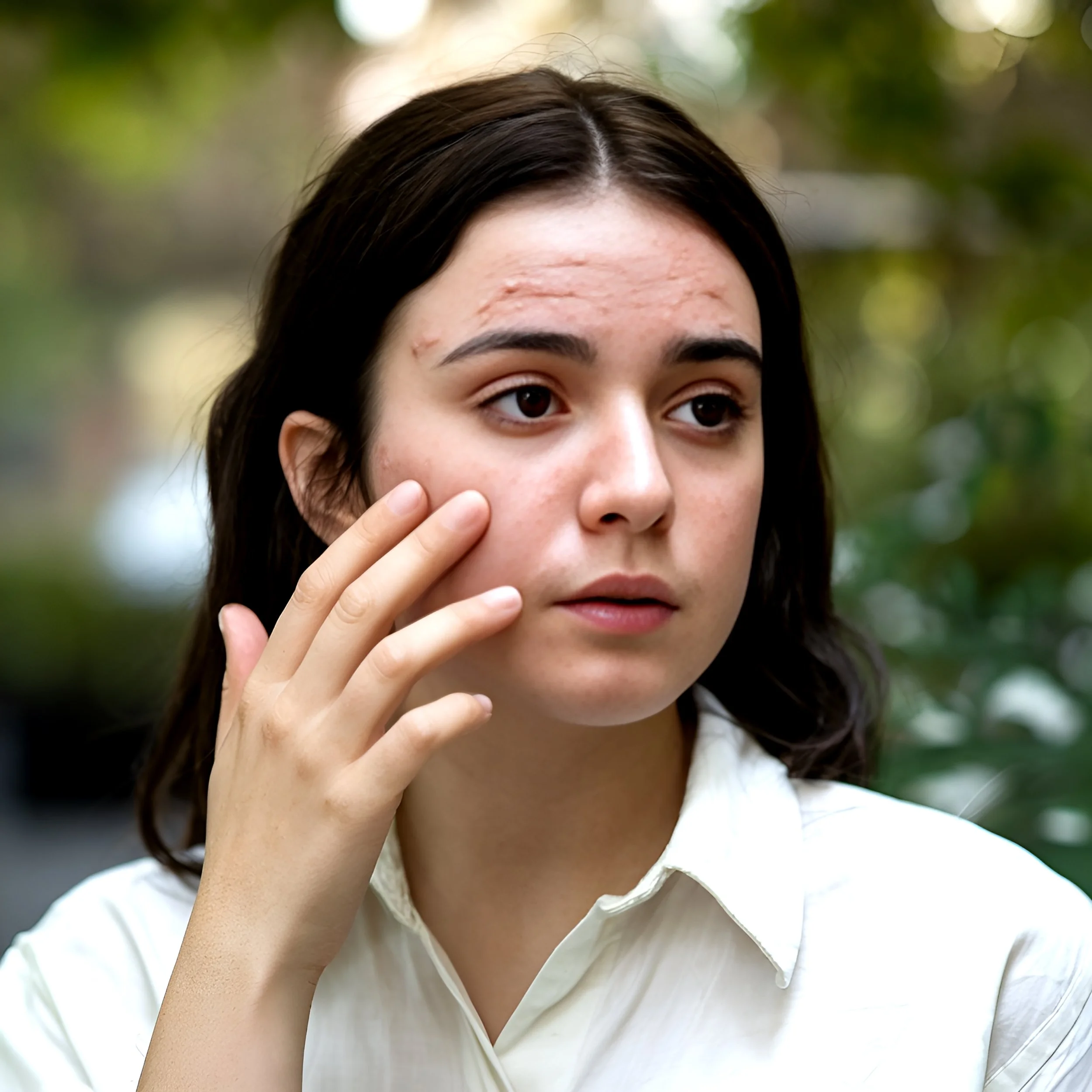 sings of skin barrier damage