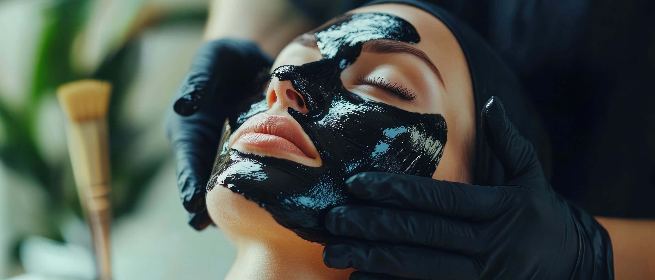 ✨ Carbon Laser Peel at Belleza 360° Aesthetics ✨🖤