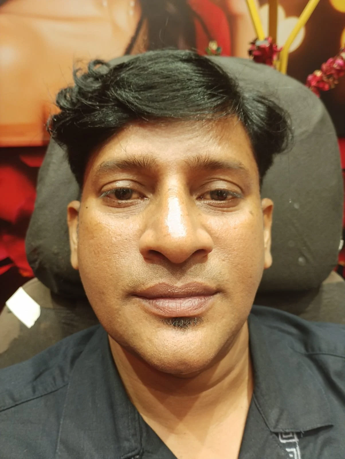 Best dermatologist in Chennai, Top skin specialist in Chennai, Chennai skin clinic reviews, Experienced dermatologist Chennai, Best skin doctor for acne in Chennai, Trusted dermatologist in Chennai