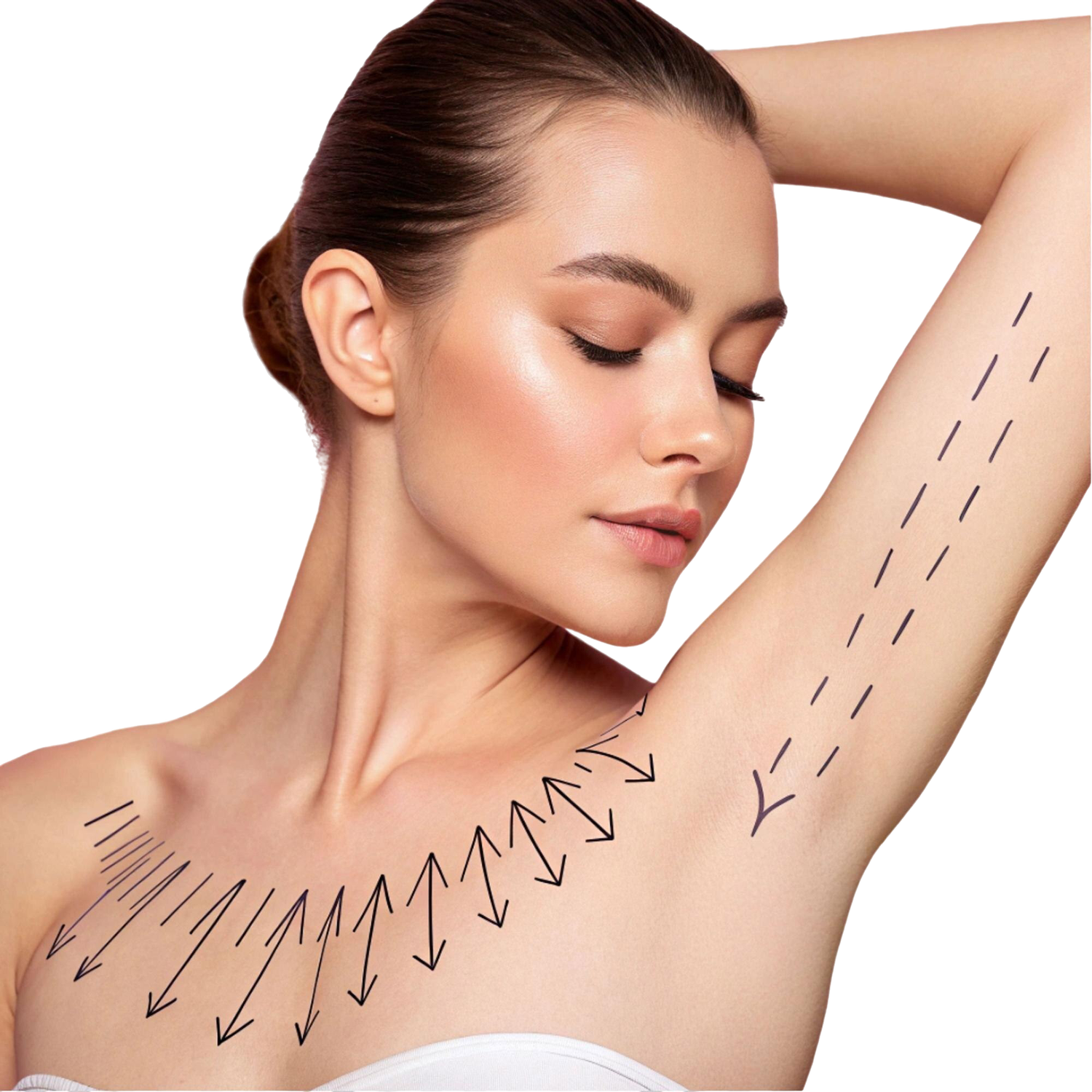 Stretch marks treatment in Chennai, Stretch marks removal clinic in Chennai, Best skin clinic in Chennai for stretch marks, Stretch marks removal treatment Chennai, Laser treatment for stretch marks Chennai, Dermatologist for stretch marks in Chennai