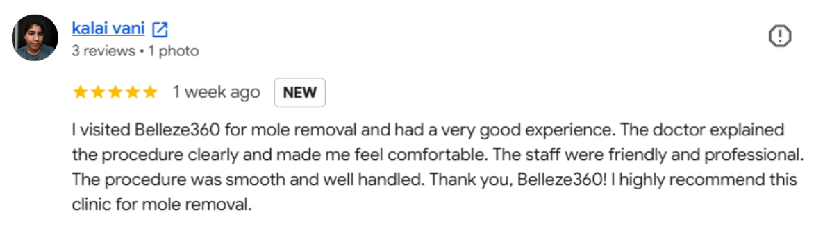 Mole removal treatment in Chennai at Belleza 360° Aesthetics