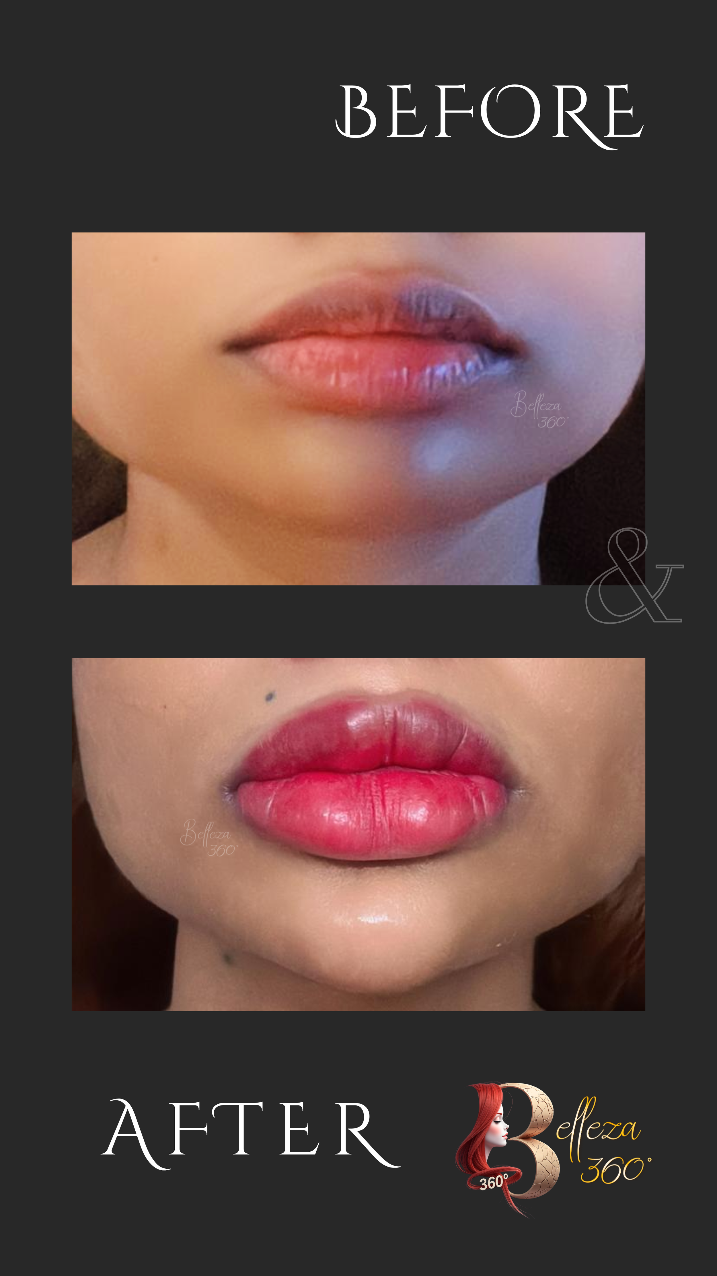 Lip blushing in Chennai, Best lip blushing clinic Chennai, Lip tinting treatment Chennai, Semi-permanent lip color Chennai, Lip blushing cost in Chennai, Natural lip blushing Chennai