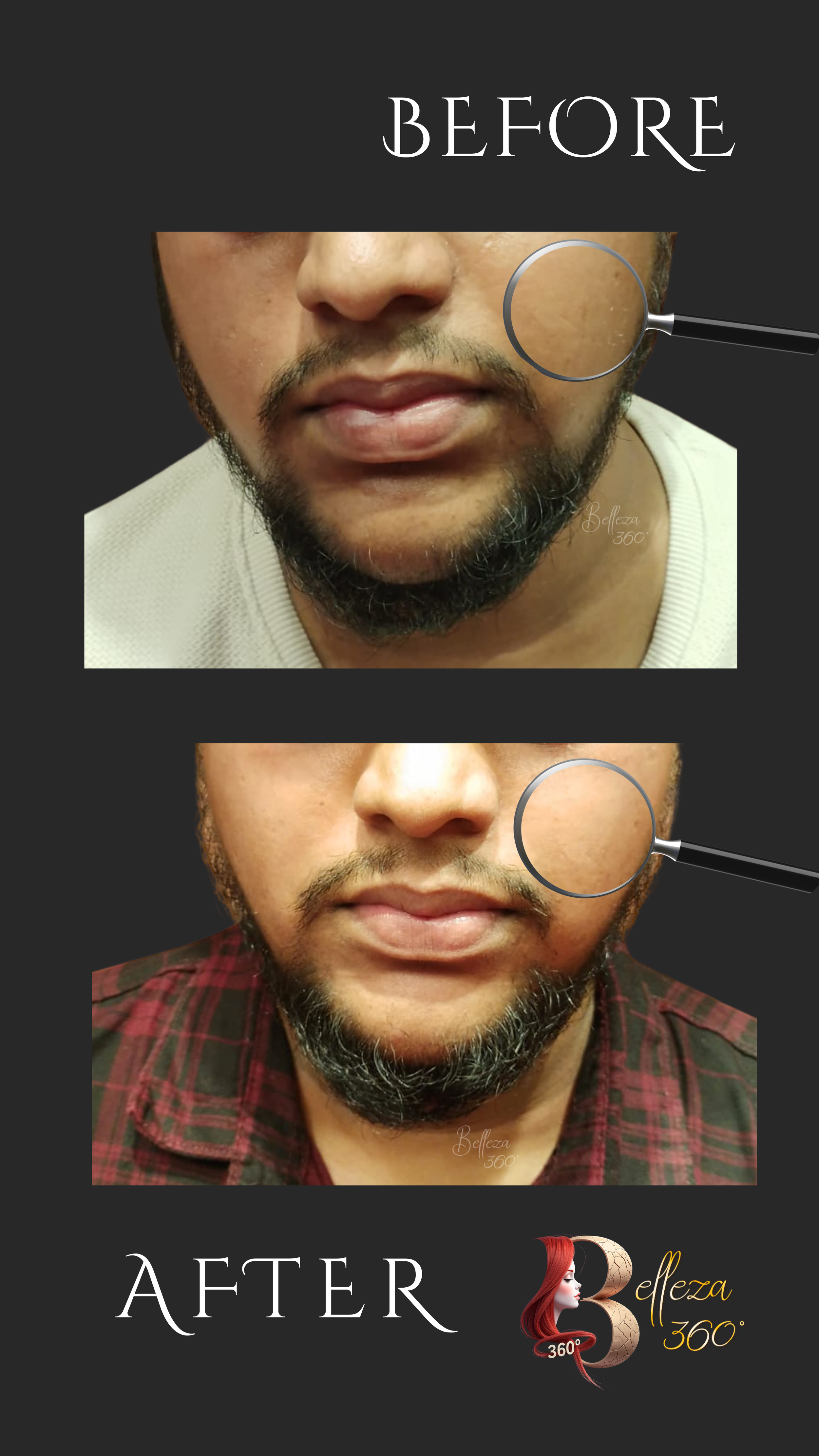 Korean glass skin treatment, Glass skin facial treatment, Korean skin brightening treatment, Glass skin laser treatment, Korean facial treatment, Glass skin clinic, Korean skincare treatment, Glass skin rejuvenation