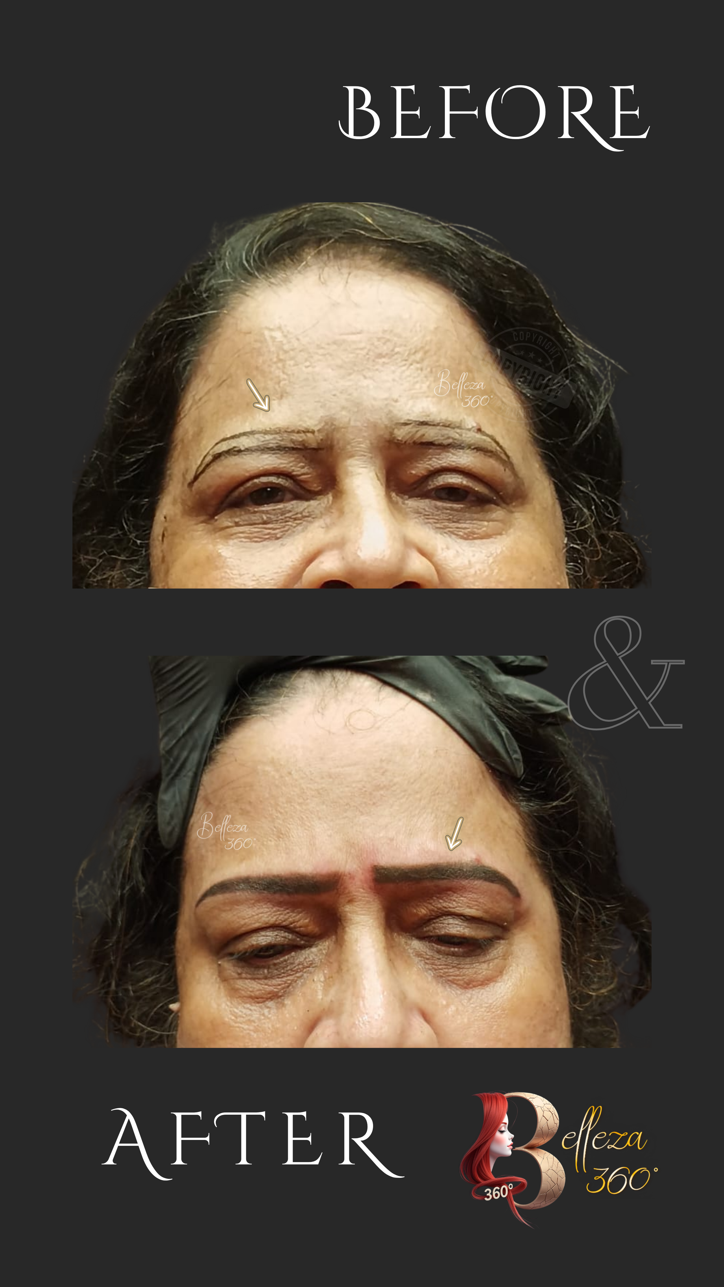 Ombré powder brows in Chennai, Best Ombré brows clinic Chennai, Semi-permanent eyebrow tattoo Chennai, Ombré brow shaping Chennai, Ombré powder brows cost in Chennai, Natural Ombré brows Chennai