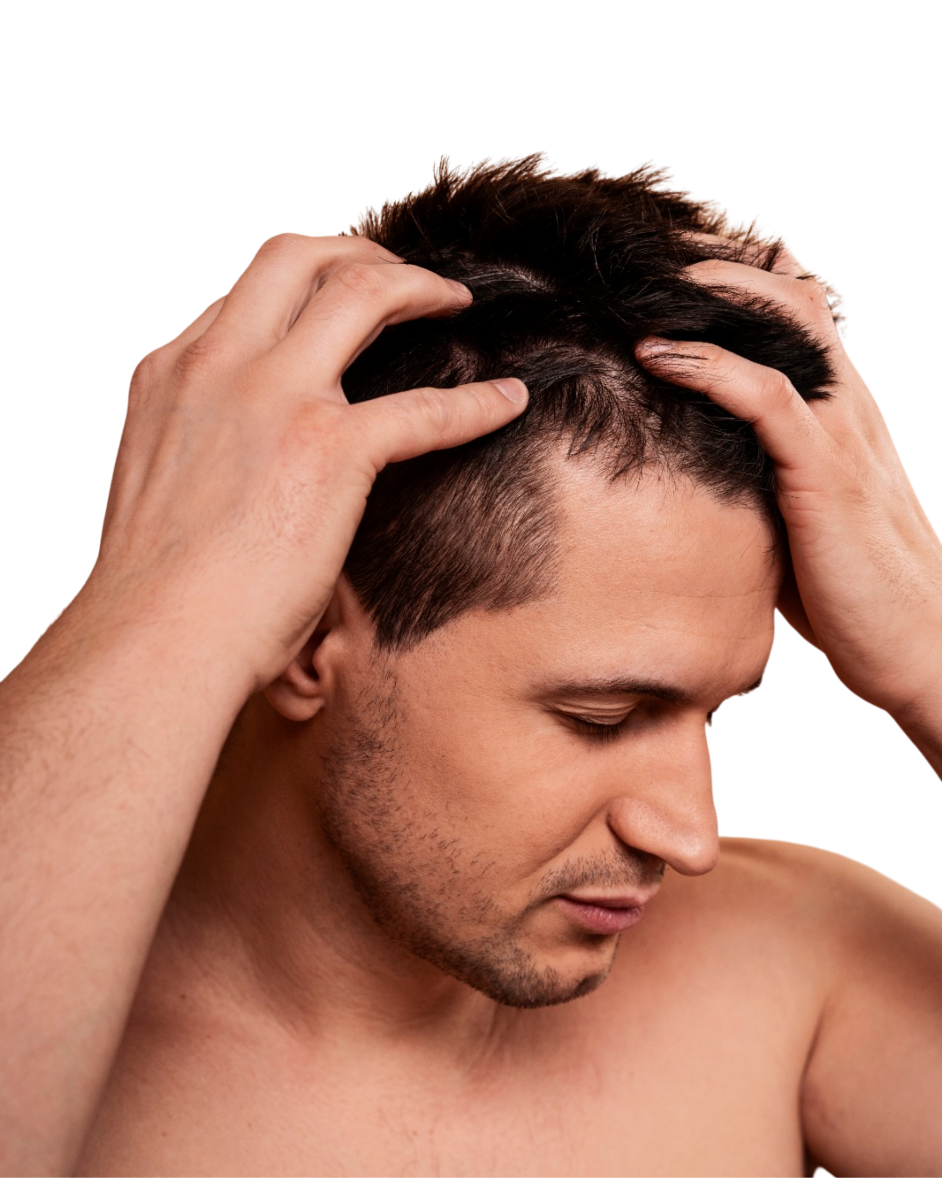 Telogen effluvium treatment in Chennai, Best skin clinic in Chennai for telogen effluvium, Hair loss specialist Chennai, Hair thinning treatment Chennai, Stress-related hair fall care Chennai, Advanced telogen effluvium solutions Chennai