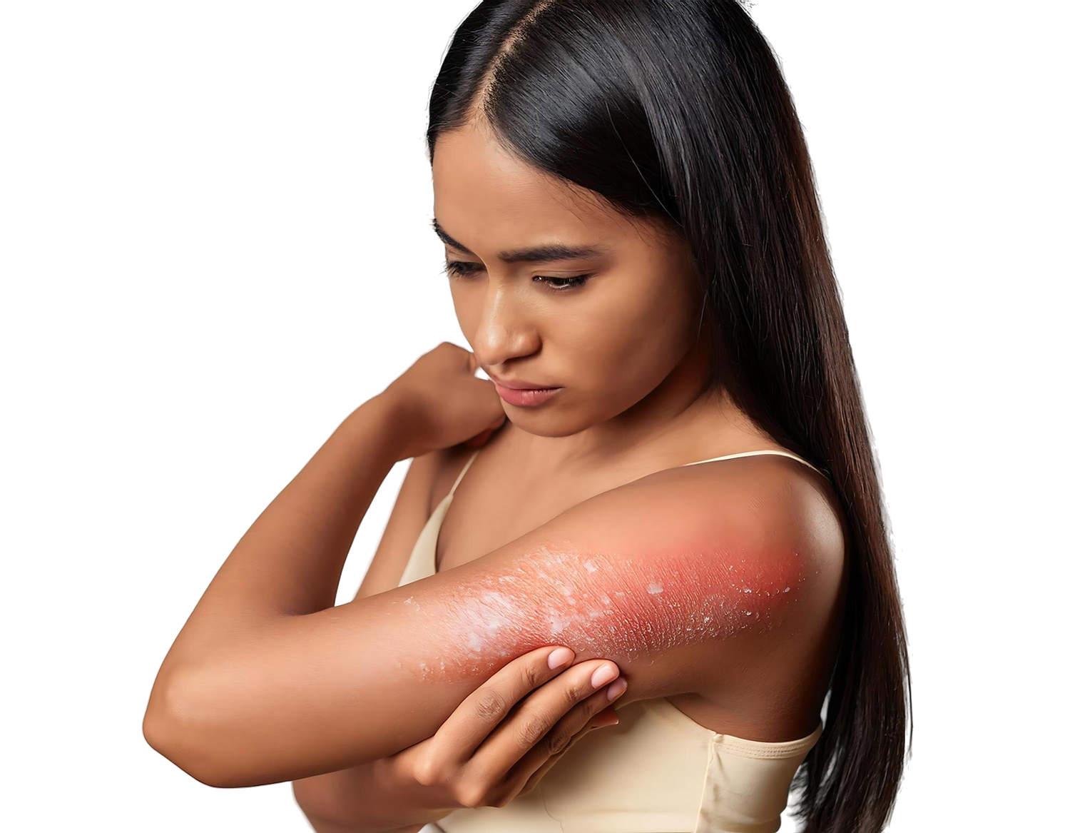 Psoriasis treatment in Chennai, Best skin clinic in Chennai for psoriasis, Psoriasis dermatologist in Chennai, Advanced psoriasis care Chennai, Chronic skin disease treatment Chennai, Skin clinic for psoriasis in Chennai