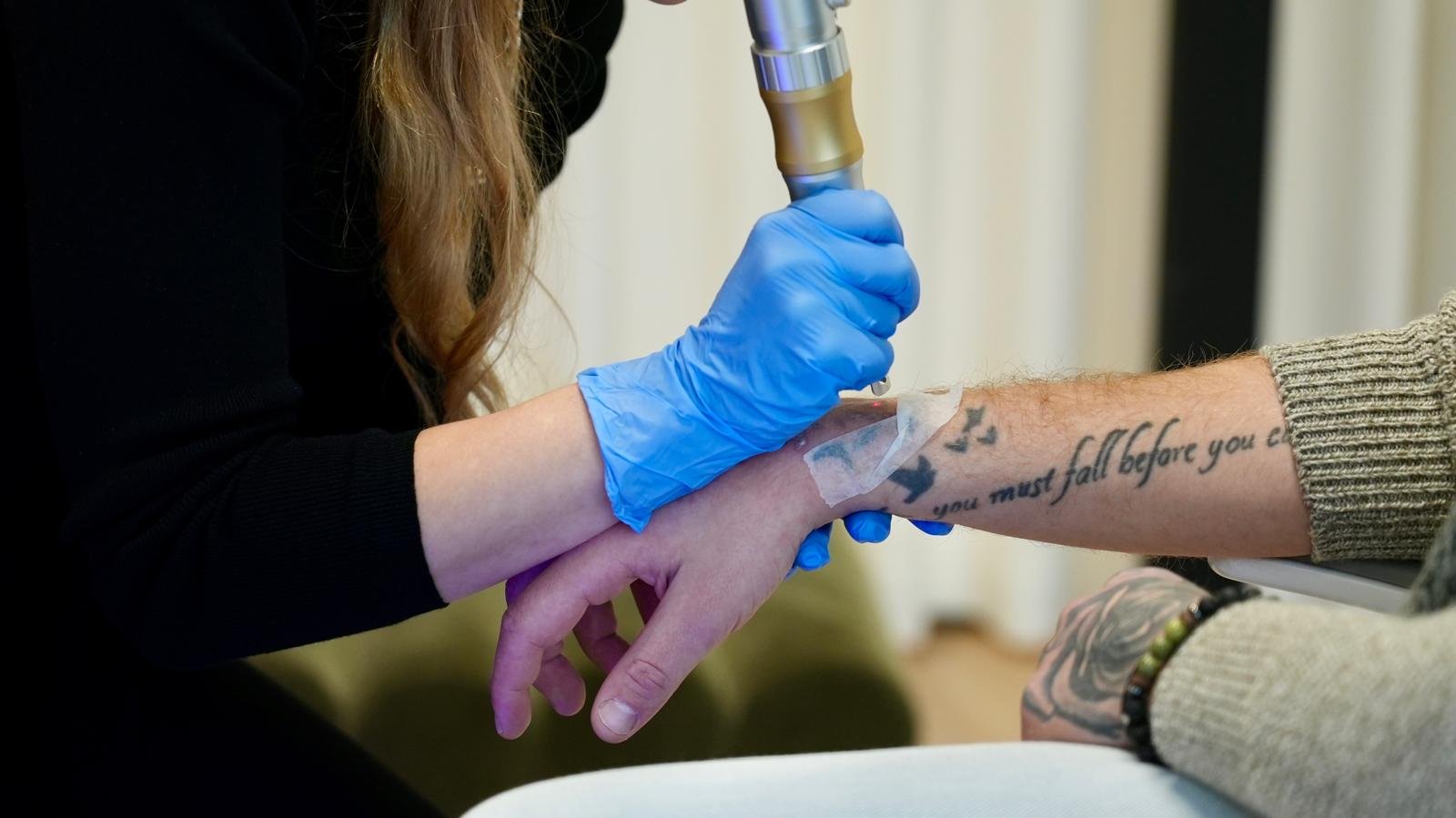 Kuidas valida parim tätoveeringu eemaldamise kliinik – ekspertide nõuanded