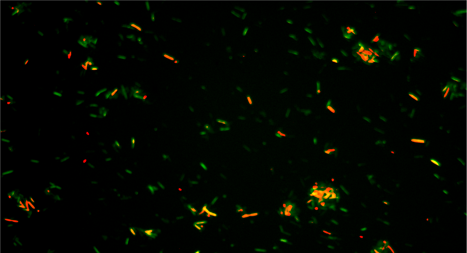Fluorescent bacteria or cells under a microscope emitting green and red light on a black background.