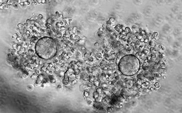Microscopic view of cells or particles in a gray-scale image.